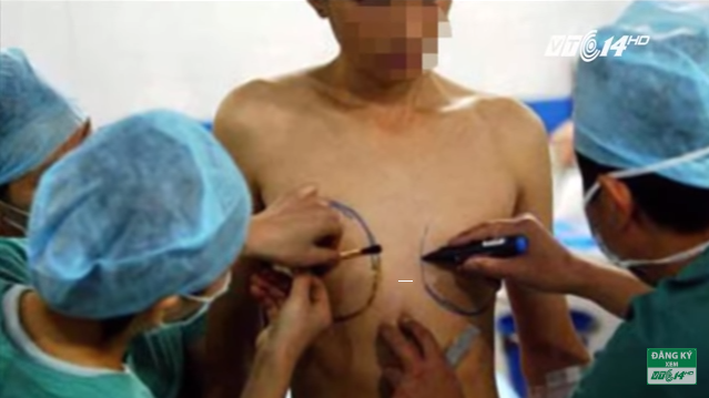 Gần 300.000 người Việt mong muốn chuyển giới