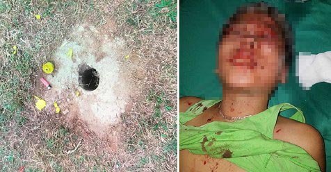 Vật lạ phát nổ ở Thái Nguyên, 4 học sinh thương nặng