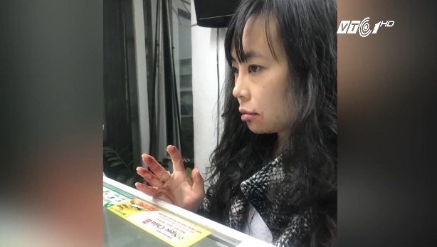 Tài xế Uber bị tố đánh khách nữ bầm mặt