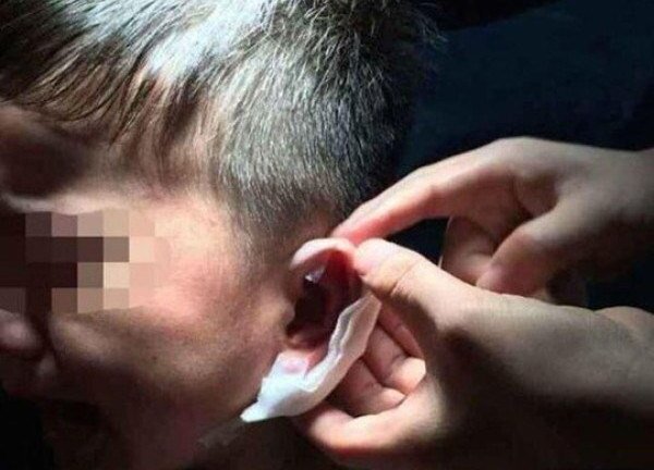 Những vụ bạo hành trẻ chấn động thế giới: Dập ghim vào tai, đâm trọng thương trẻ nhỏ