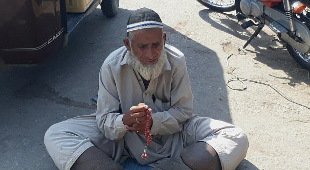 Người đàn ông có đôi chân nặng 12 kg do rối loạn di truyền