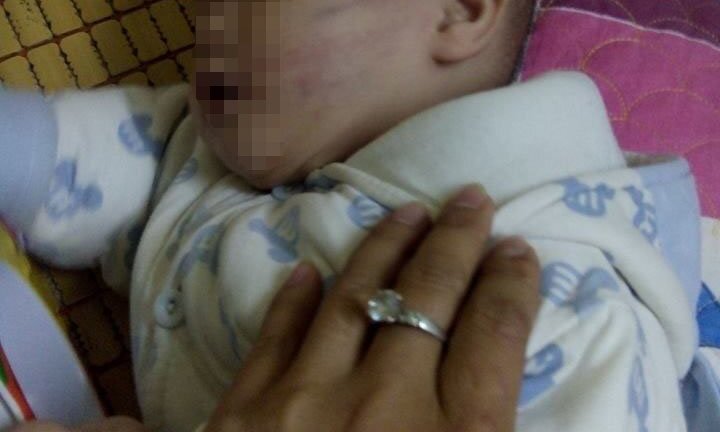 Lại thêm 1 bé trai bị bạo hành ở nhà trẻ đến mức bầm tím mặt mày