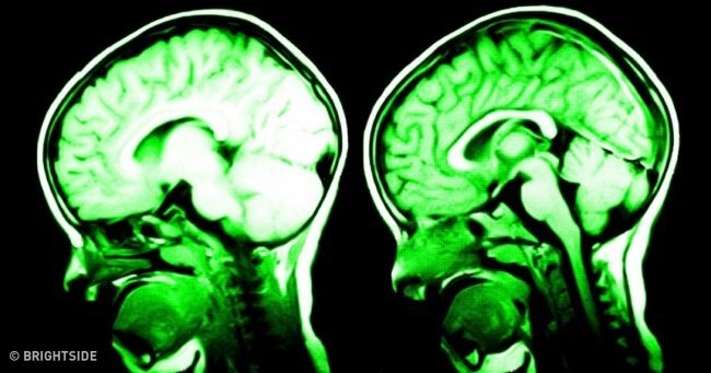 7 cách khiến não bộ hạnh phúc hơn