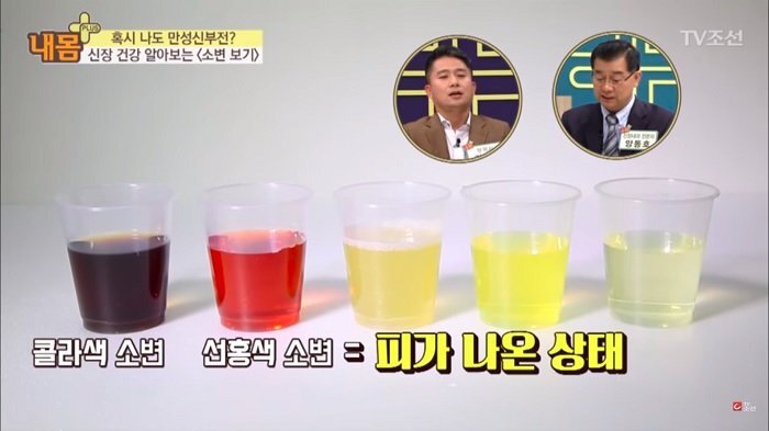 Chuyên gia cảnh báo cơ thể bạn có thể đang mắc bệnh