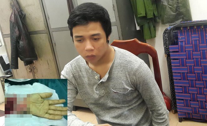 Khách hát karaoke chém đứt bàn tay nhân viên quán