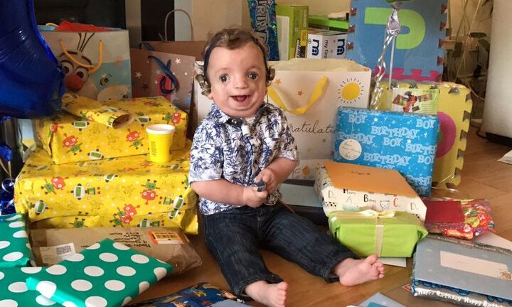 Xúc động trước sự lạc quan của cậu bé mắc hội chứng kì lạ khiến ngoại hình dị dạng