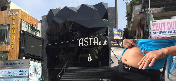 Xin 'cơ cấu' giải thưởng bất thành, dùng vật nhọn đâm thủng bụng chủ quán bar