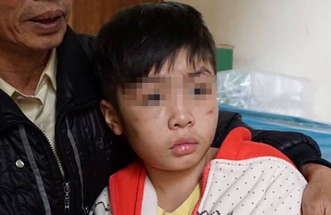 Bé 10 tuổi bị bạo hành: Các hội đoàn thể ở đâu?