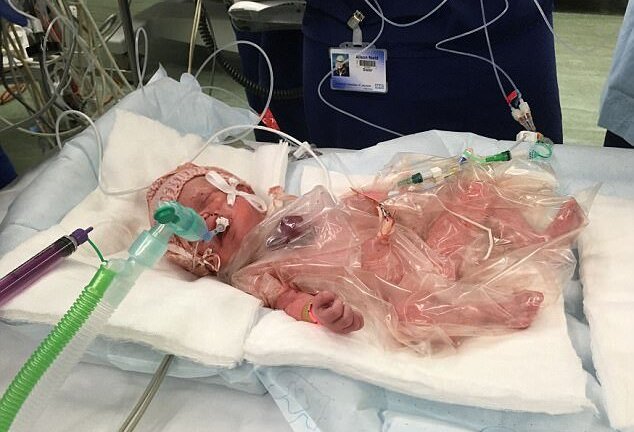 Hy hữu: Bé gái sống sót kỳ diệu với trái tim nằm ngoài lồng ngực