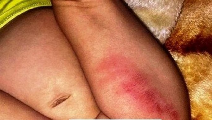 Sự thật bé gái 16 tháng tuổi nghi bị bạo hành tại điểm giữ trẻ tư nhân ở Huế