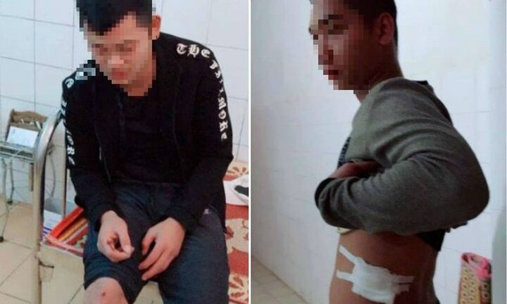 Nhóm côn đồ Nam Định rút súng bắn lái và phụ xe khách, đâm trọng thương chủ xe