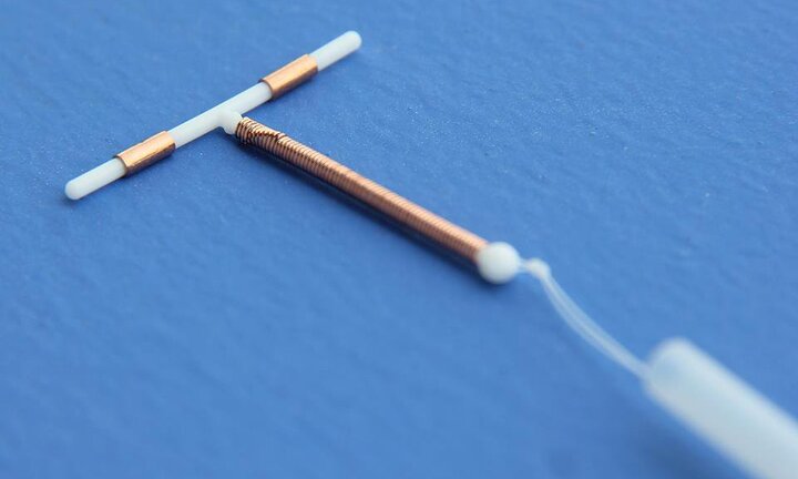 Cận cảnh quy trình đặt vòng tránh thai, xem mà thấy thương phụ nữ