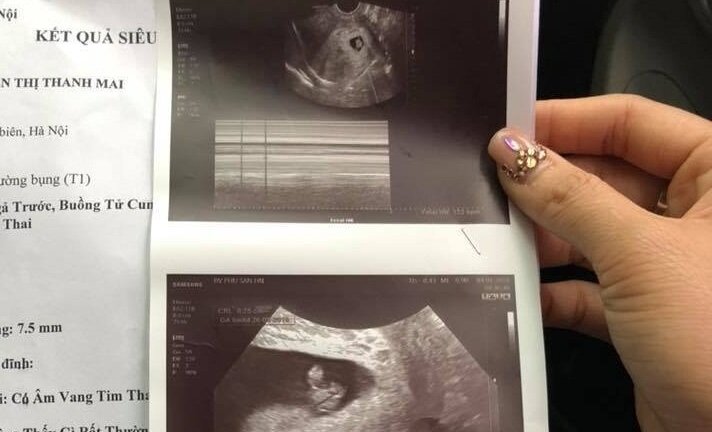 Sản phụ Hà Nội 'tố' bác sĩ tắc trách suýt phải bỏ thai: Bộ Y tế chỉ đạo xử lý nghiêm