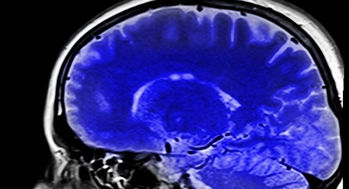 Tìm ra bí quyết giúp não bộ luôn minh mẫn