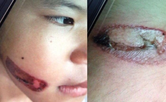 Những vụ bạo hành trẻ em rúng động dư luận