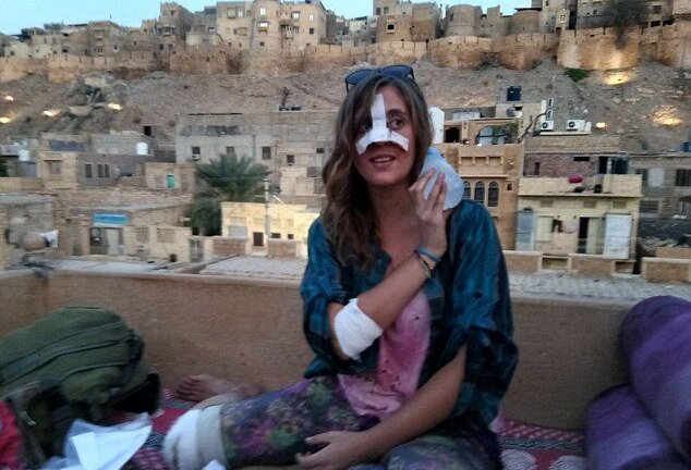 Bị ép nghe nhạc rap, bò nổi điên, lao vào húc vỡ mũi nữ du khách