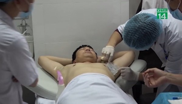 Clip: Chữa hôi nách không cần phẫu thuật