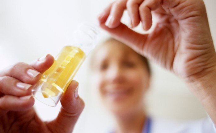 Xét nghiệm nước tiểu có thể dự đoán được cái chết