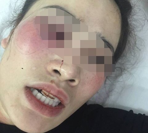 Nam thanh niên đánh cô gái trong quán bánh xèo: Cha lên facebook xin lỗi thay con