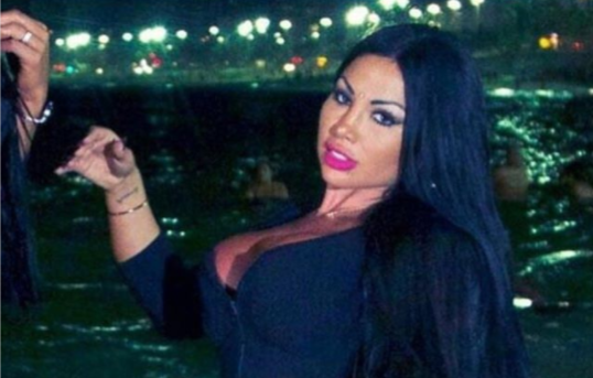 Phẫu thuật thay đổi màu mắt, người mẫu rước họa vào thân