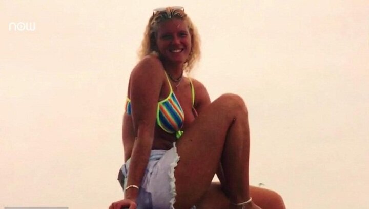 Nghiện nhuộm da nâu, mắc ung thư phải lên bàn mổ 86 lần đầy đau đớn