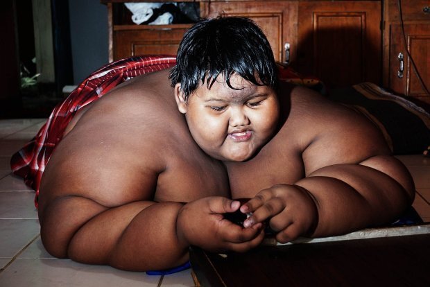 Cậu bé béo nhất thế giới giảm 83 kg ngoạn mục