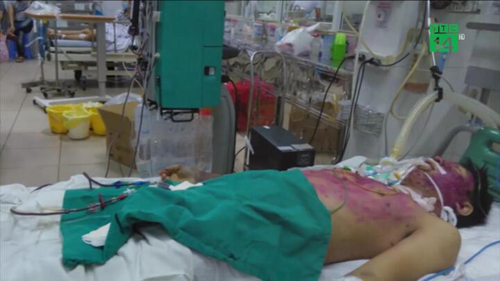 Tự ý uống thuốc chữa thủy đậu, người đàn ông suy nội tạng nguy kịch