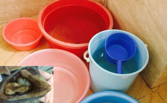 Bi hài chuyện chung cư Bệnh viện 103 'mùa mất nước'