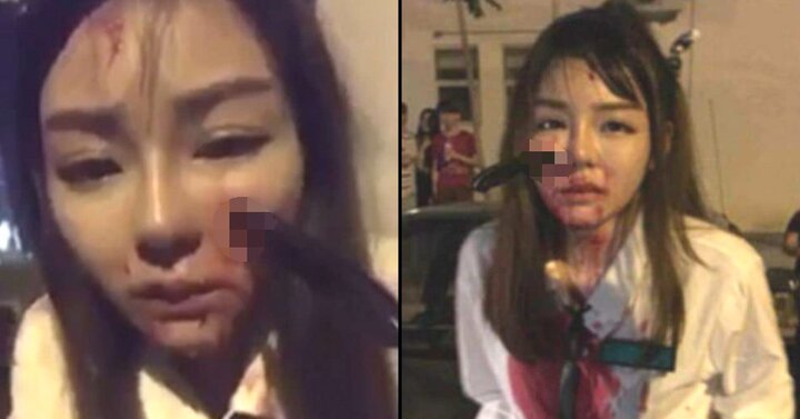 Video: Chống trả lại tên cướp, cô gái bị găm dao lên mặt