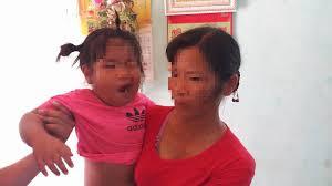 Giáo viên bị tố đánh bé 3 tuổi đến méo miệng: Không có chuyện cô giáo đã nghỉ việc