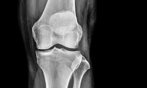 Làm ngay 7 điều này cho xương, bạn khỏi lo phải 'bò, lết' khi về già