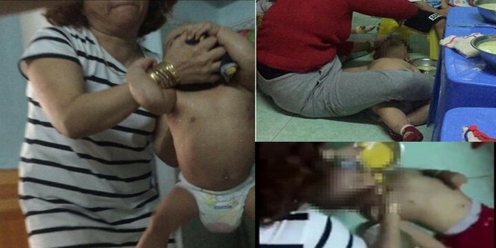 Bảo mẫu vừa bóp đầu vừa tát dã man trẻ mầm non ở Đà Nẵng gây phẫn nộ