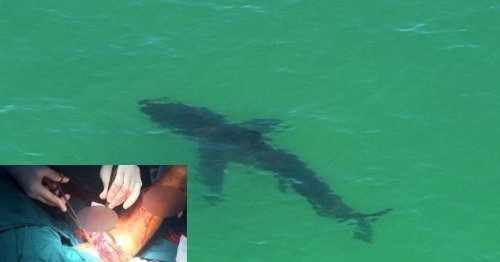 Ngư dân bị cá mập cắn bầm dập ở biển Bạch Long Vĩ