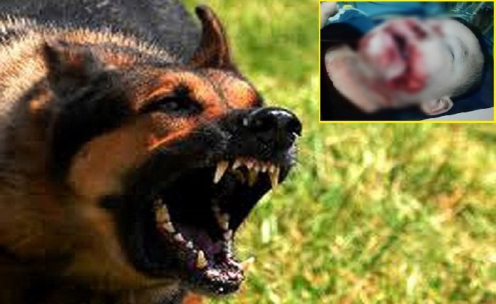 Người mẹ để con bị chó cắn rách mặt: Nỗi ám ảnh thường trực vì lo con bị dại