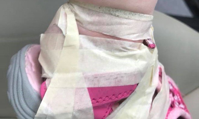 Quấn băng dính chặt vào chân trẻ, hai cô giáo mầm non bị đuổi việc