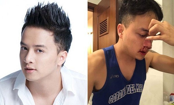 Cao Thái Sơn nhập viện cấp cứu trong đêm vì máu mũi chảy liên tục