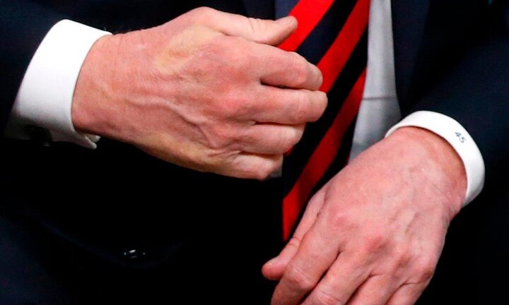 Cái bắt tay bất thường của Tổng thống Pháp, khiến tay ông Trump in rõ vết hằn