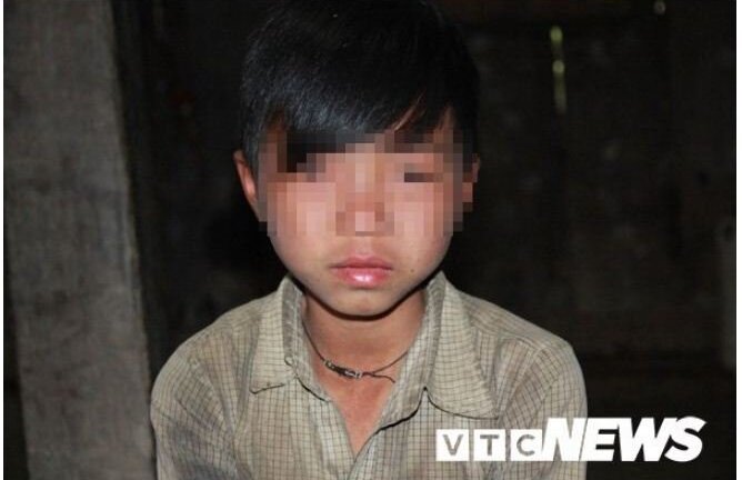 Những đứa trẻ bị 'giời hành' có hai 'của quý' ở Hà Giang: Đều mắc các bệnh thuộc nhóm bệnh hiếm