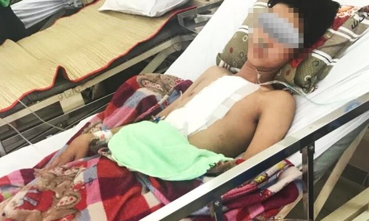 Báo động đỏ liên viện cứu bệnh nhân bị đâm thủng tim, phổi nguy kịch