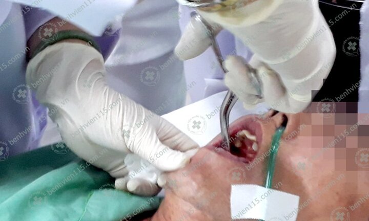 Uống thuốc quên bóc vỏ, người đàn ông ở TP.HCM ho ra máu liên tục