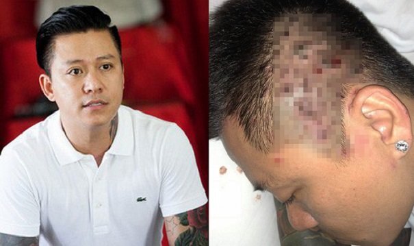 Tuấn Hưng từng căng thẳng đến mức suy sụp vì bệnh quái ác