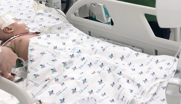 Bác sĩ chẩn đoán nhầm bệnh, bé gái 6 tháng tuổi suýt chết vì viêm màng não