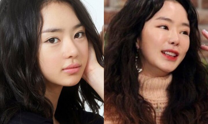 Lạm dụng dao kéo, loạt sao thế giới ngày càng khó nhận ra