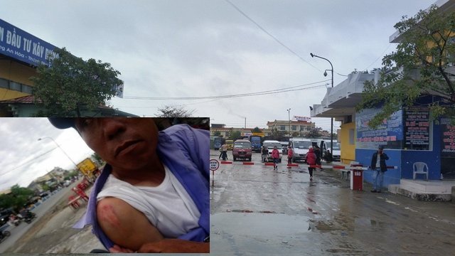 Xe ôm Grab gây sự, hỗn chiến với xe ôm nghiệp đoàn ở Huế