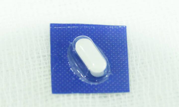 Nữ bệnh nhân ở Bình Dương suýt thủng thực quản vì nuốt cơm trắng chữa hóc vỏ thuốc