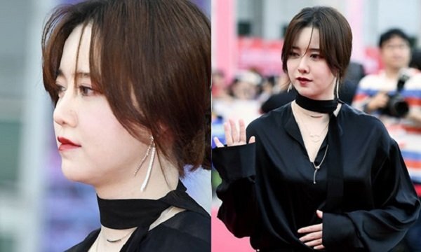 Goo Hye Sun mặt phù, tăng 10 kg sau thời gian điều trị bệnh