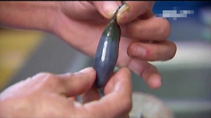 Ăn mật cá trắm chữa bệnh, người đàn ông đau bụng quằn quại nôn ra dịch vàng nâu