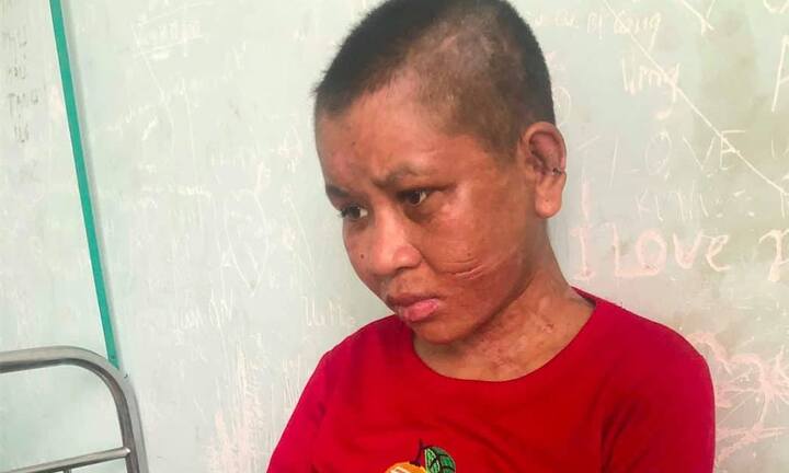 Người làm thuê tố bị chủ nhà dùng kìm bẻ răng và dao lam rạch mặt