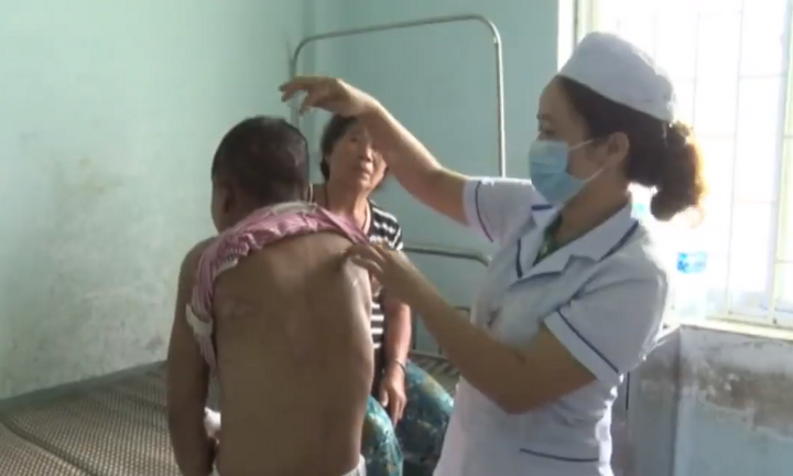 Người làm thuê tố bị dùng kìm bẻ răng và dao lam rạch mặt: Chủ nhà khai gì?