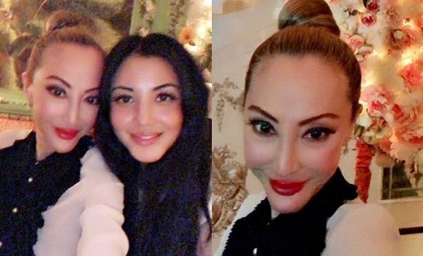 'Thảm họa thẩm mỹ' Tiết Chỉ Luân gây hốt hoảng với gương mặt nhọn hoắt